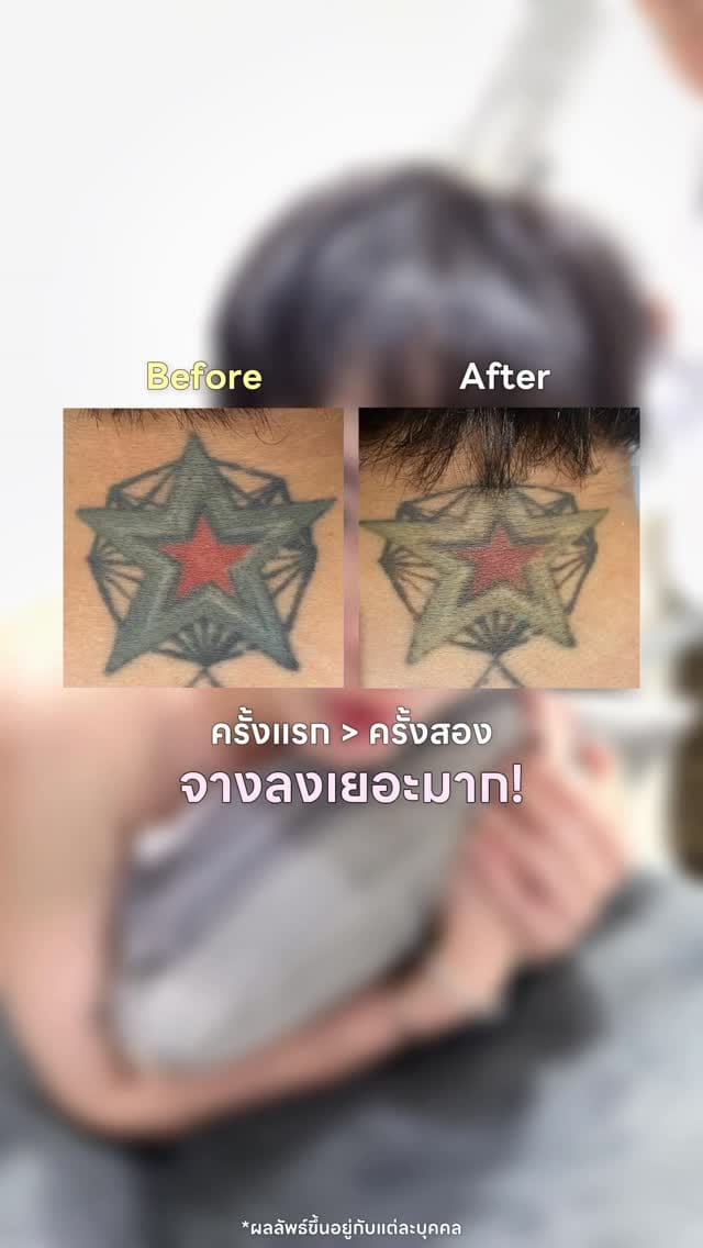 Post 5 by Secretohm Satapat Worawitwattana on Instagram (video)