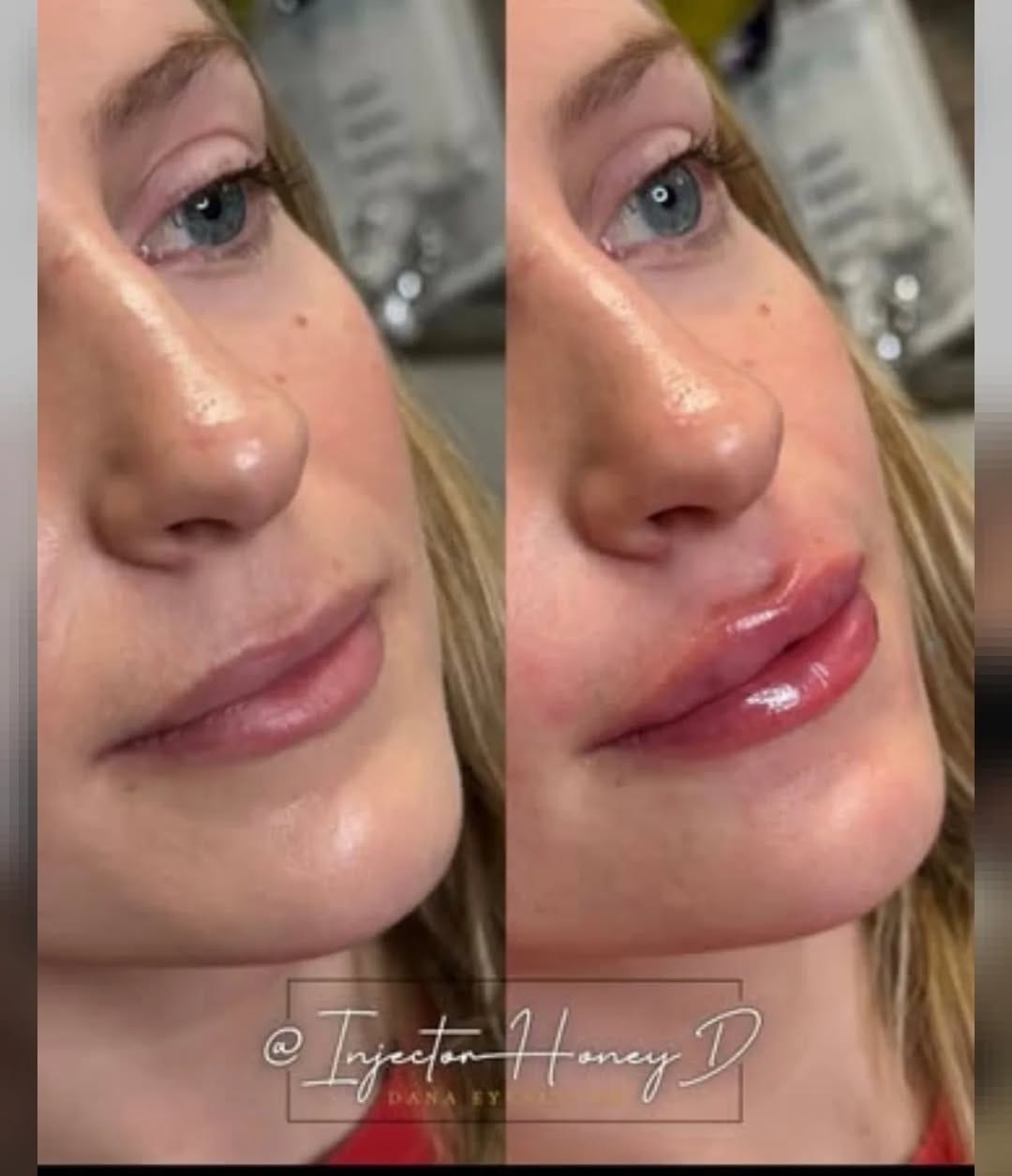 Post 2 by Med-Aesthetics America, LLC on Instagram (image)