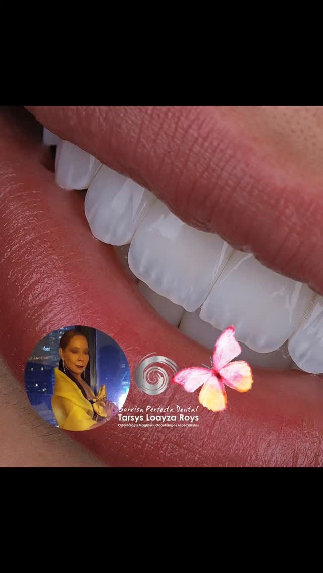 Post 1 by Sonrisa Perfecta Tarsys Loayza on Instagram (video)