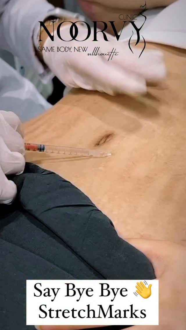 Post 7 by Dr.Nora Maged  🇪🇬🇦🇪 on Instagram (video)