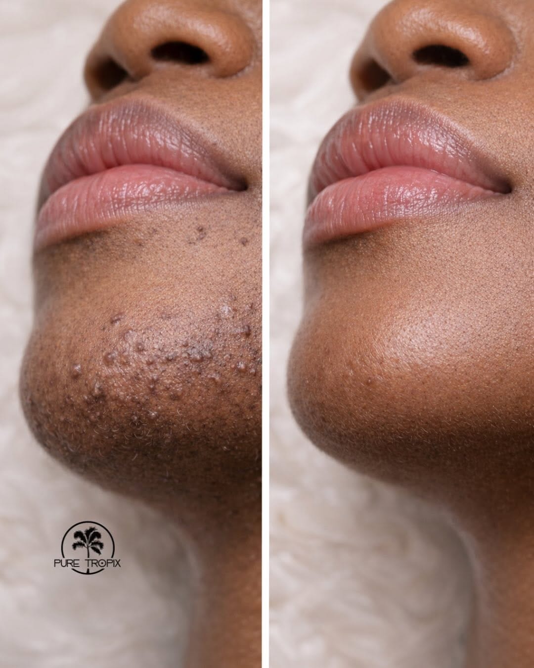 Post 1 by Pure Tropix Natural Skin Care on Instagram (carousel)