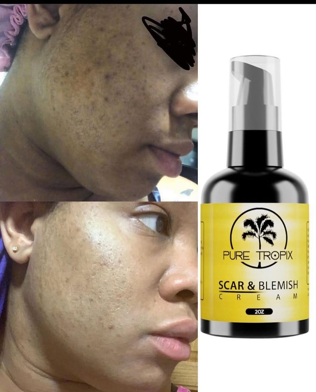 Post 5 by Pure Tropix Natural Skin Care on Instagram (carousel)