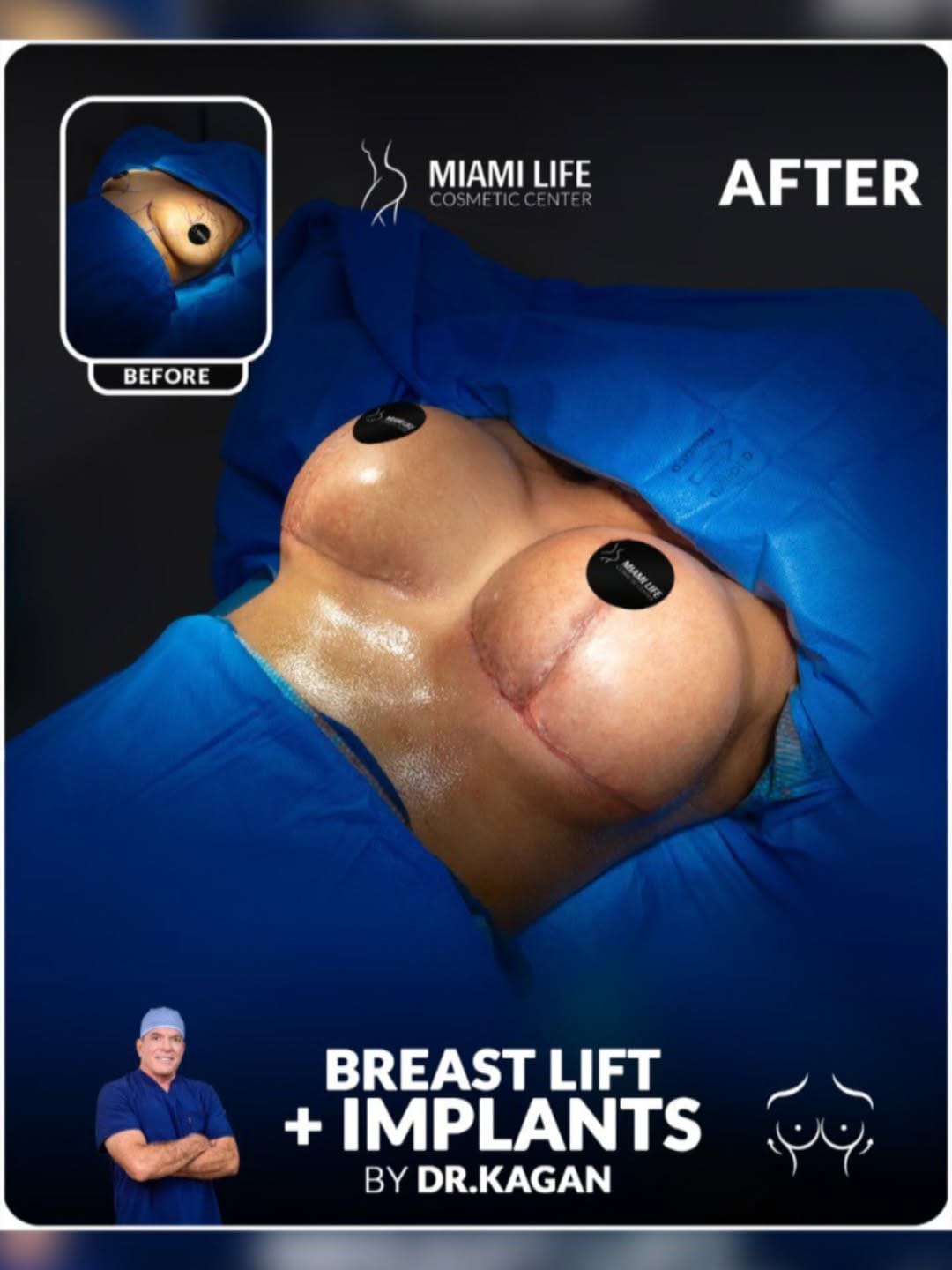 Post 6 by Miami Life Cosmetic Center on Instagram (image)