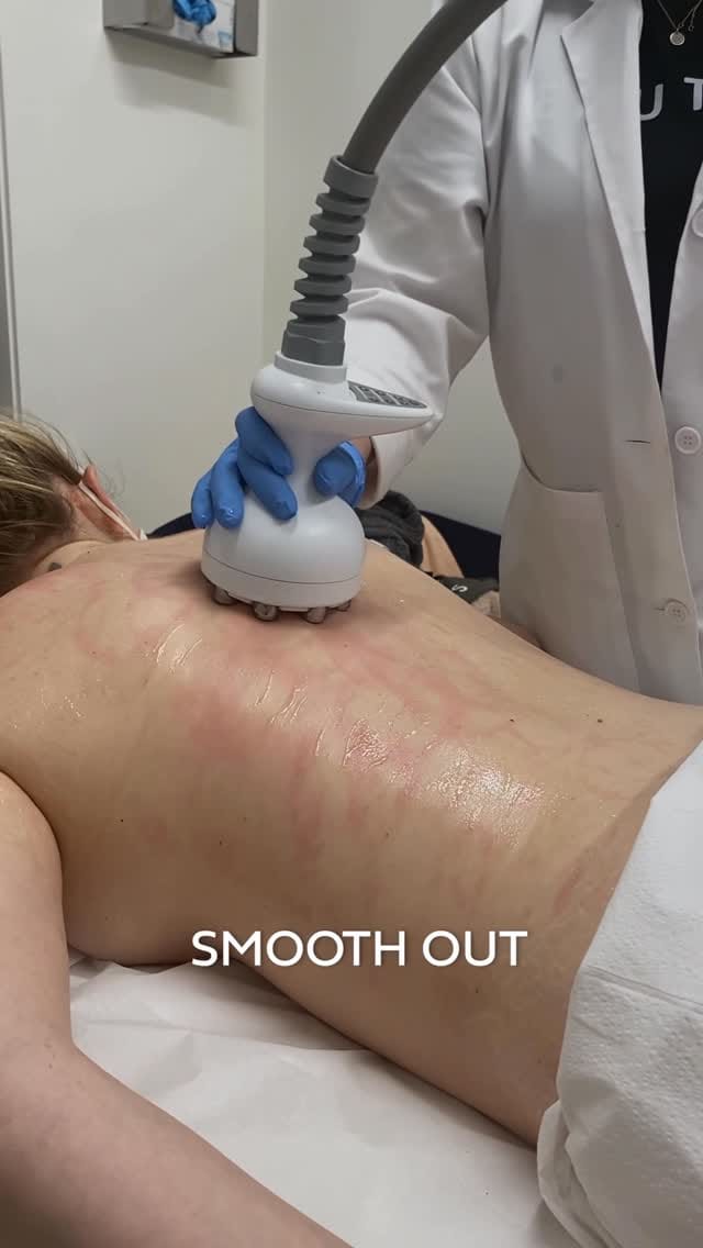Post 6 by BeautyFix MedSpa on Instagram (video)