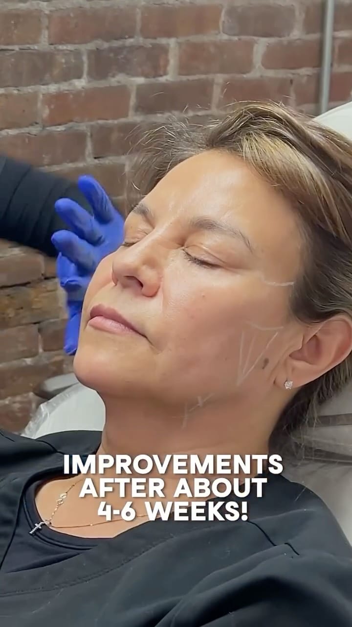 Post 3 by BeautyFix MedSpa on Instagram (video)