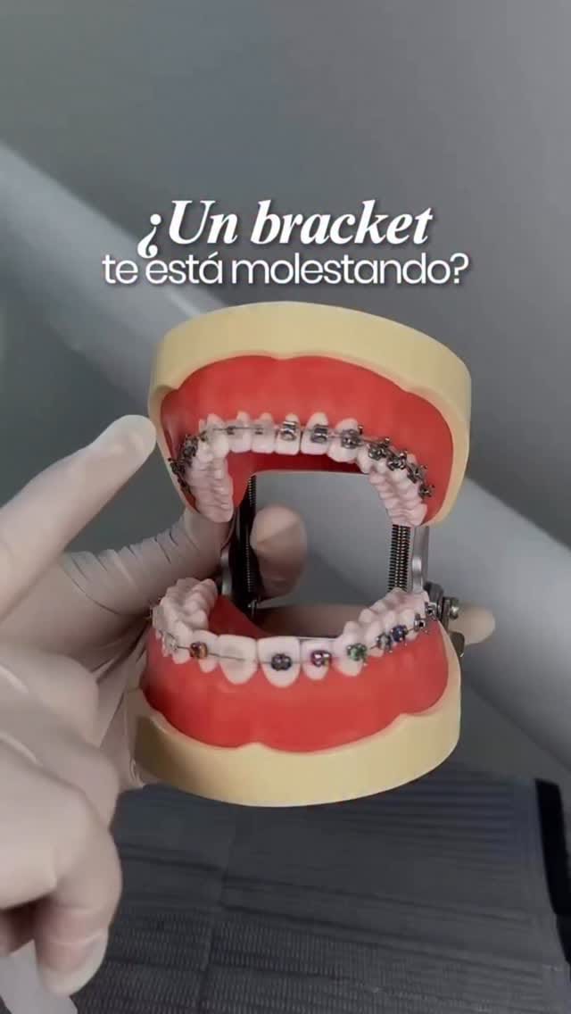 Post 6 by OdontoStudio Lima - Clínica Dental on Instagram (video)