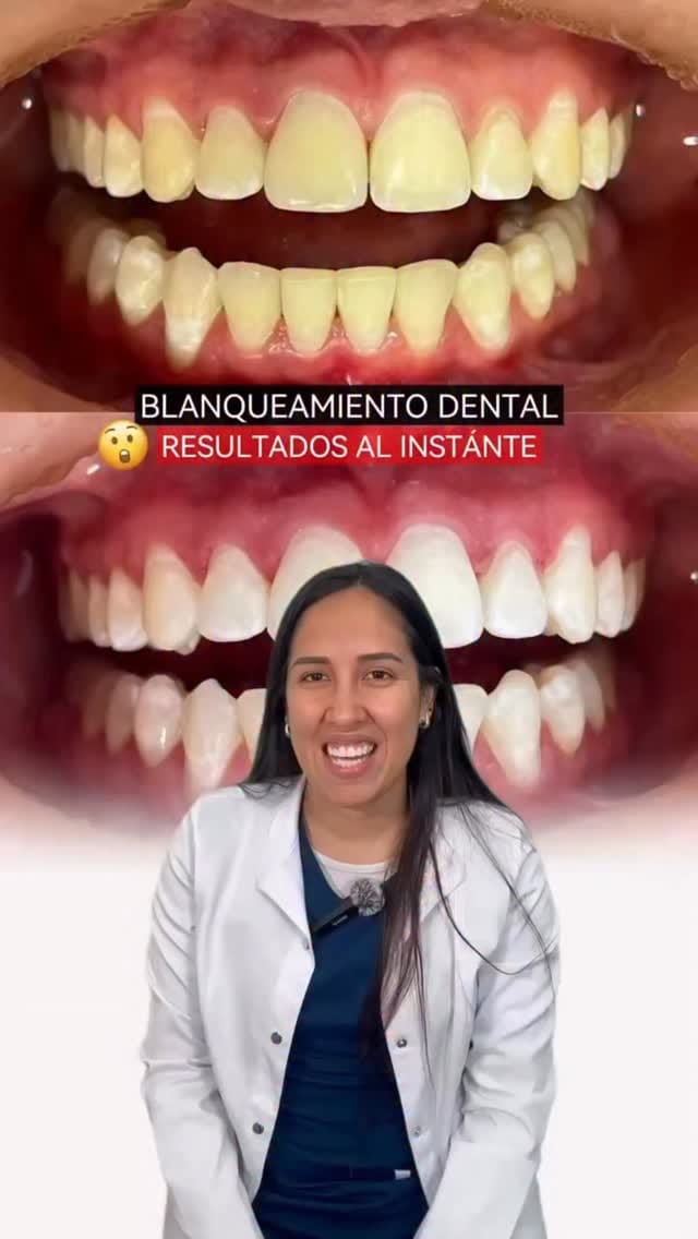 Post 7 by OdontoStudio Lima - Clínica Dental on Instagram (video)