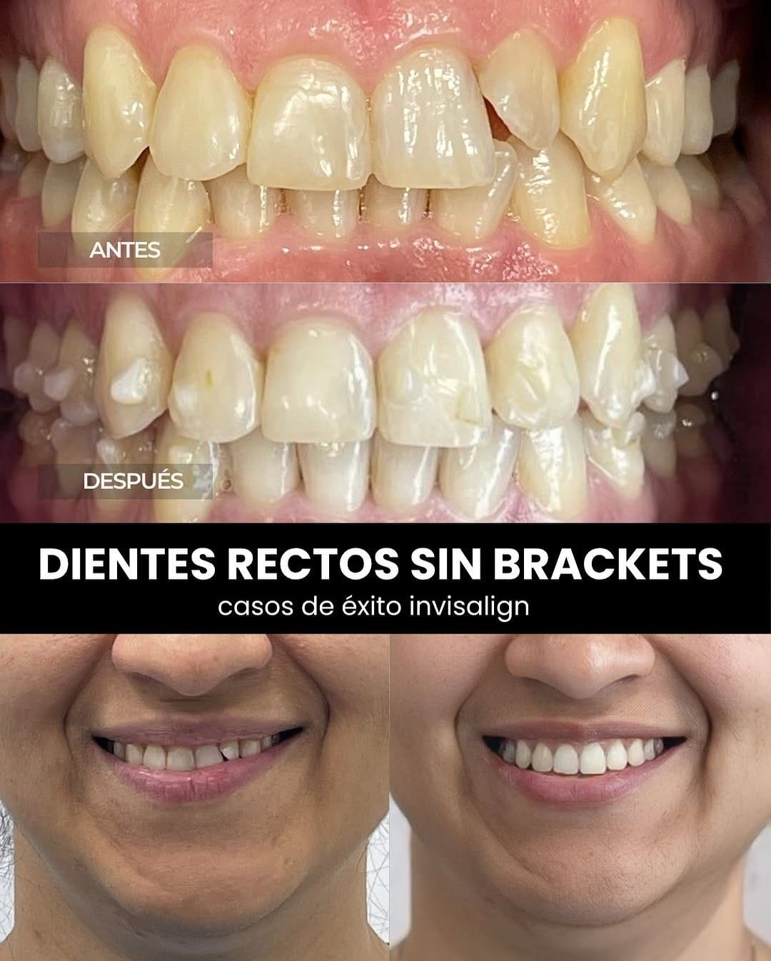 Post 8 by OdontoStudio Lima - Clínica Dental on Instagram (carousel)