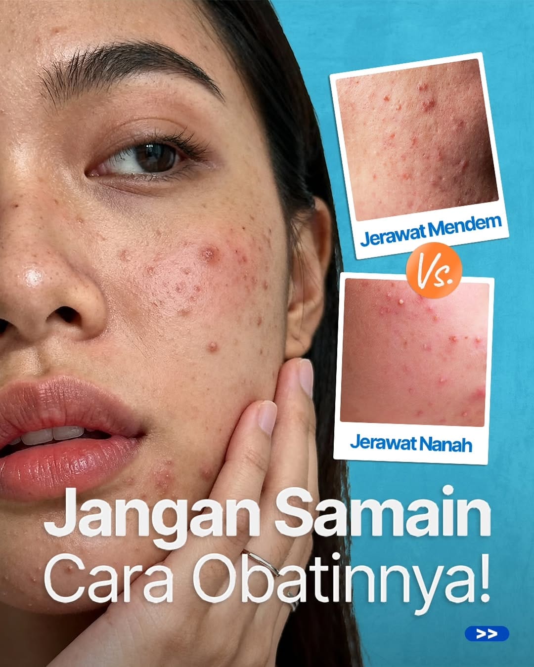 Post 4 by Diri Care | Klinik Online Kulit & Rambut on Instagram (carousel)