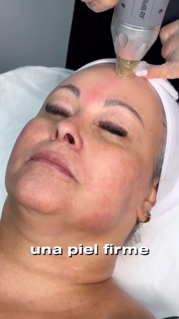 Post 2 by Aldana Skin Life©️ on Instagram (video)