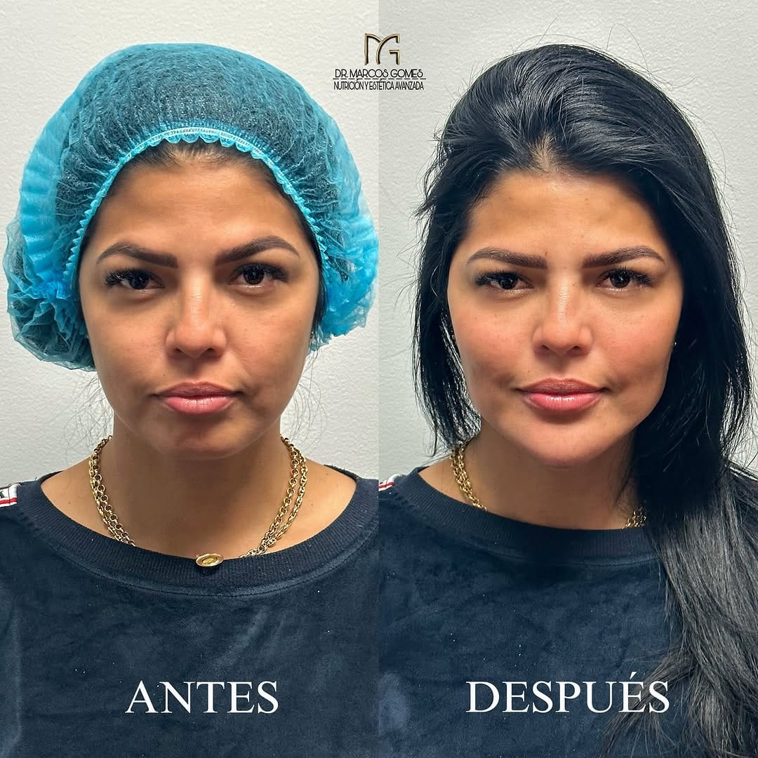 Post 10 by Drº Marcos Gomes on Instagram (carousel)