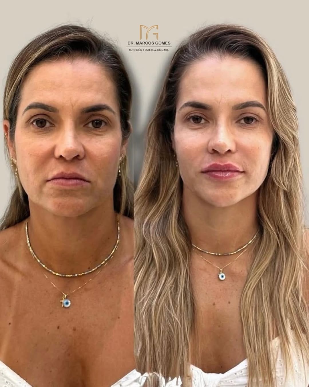 Post 1 by Drº Marcos Gomes on Instagram (image)