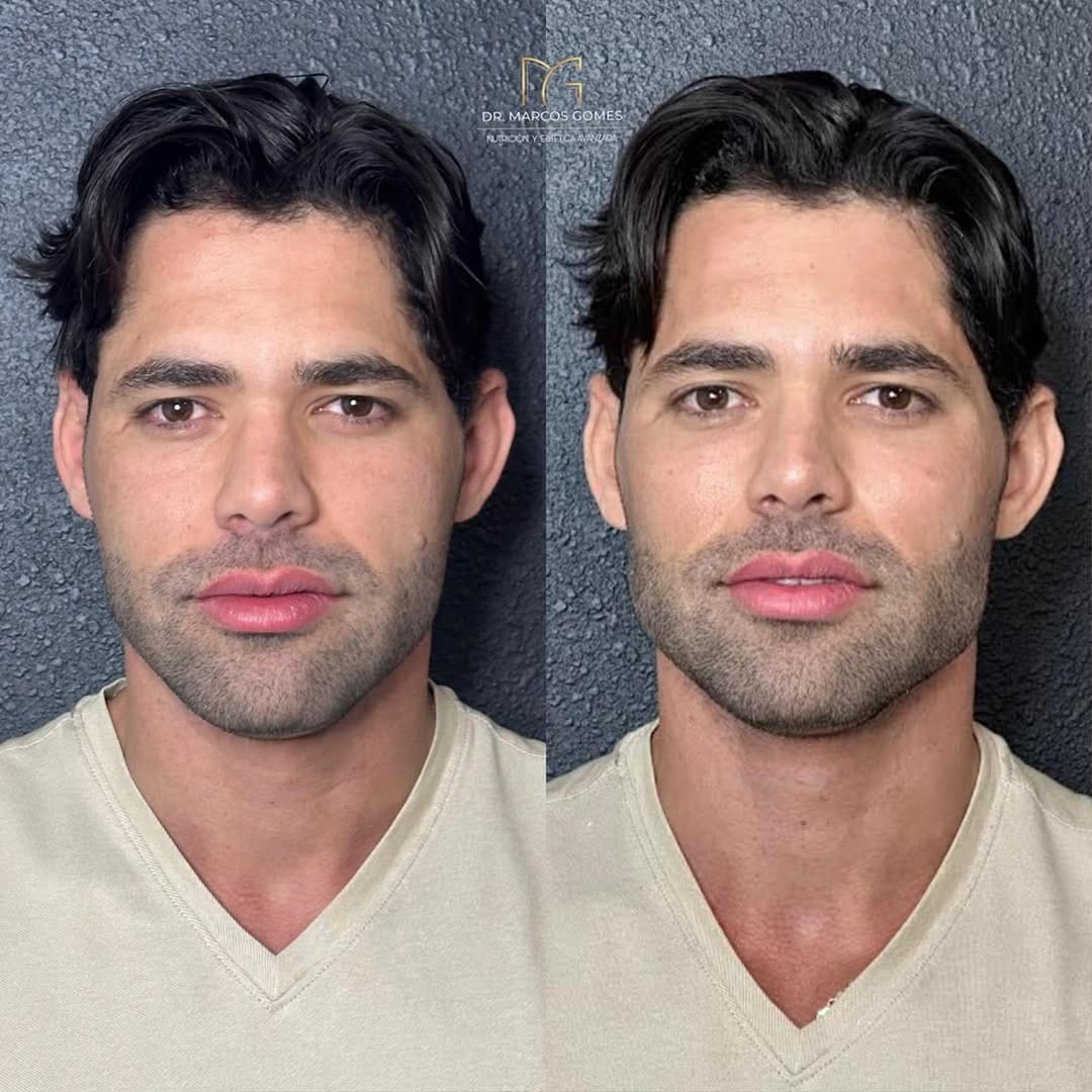 Post 9 by Drº Marcos Gomes on Instagram (carousel)