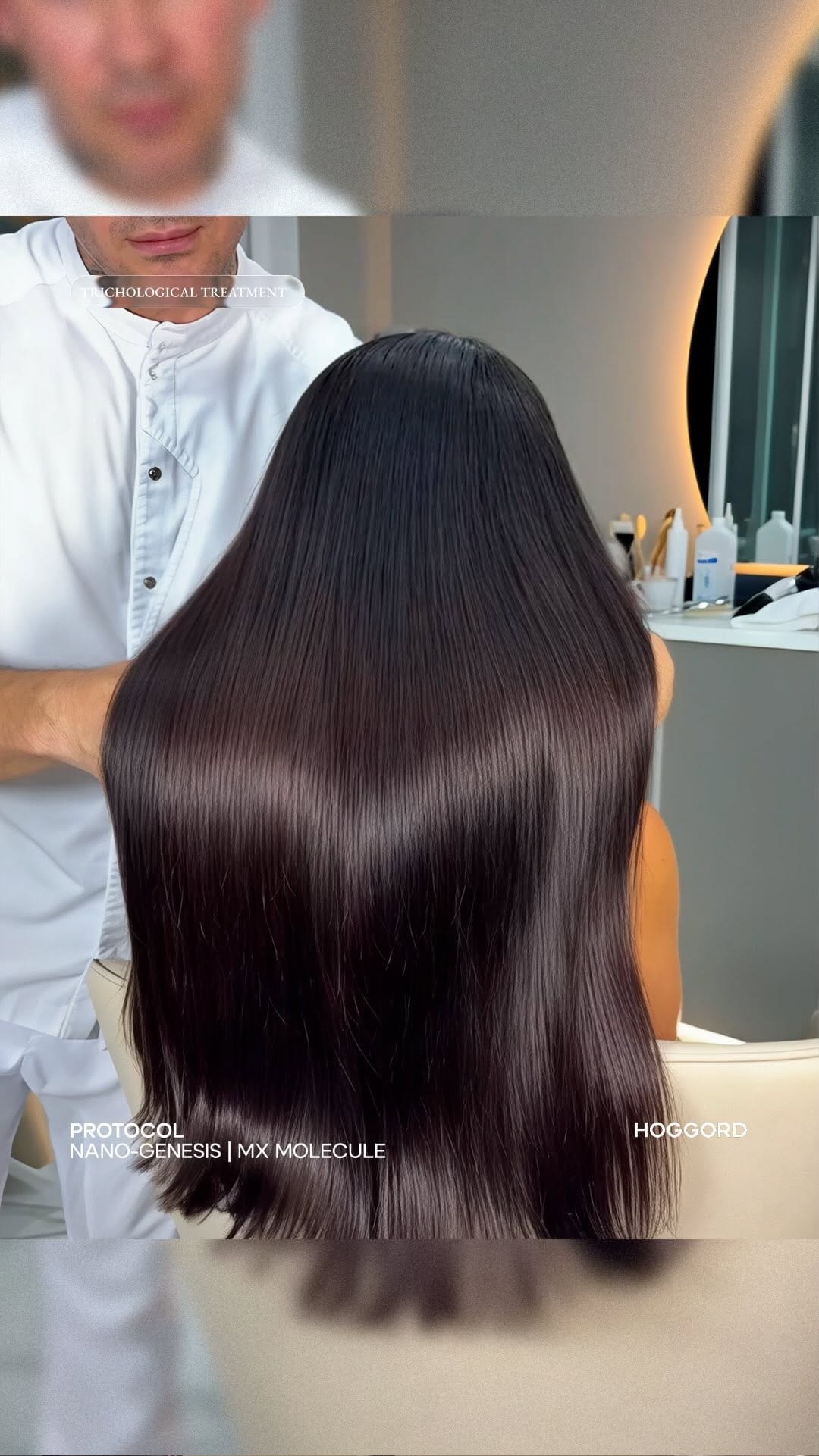 Post 5 by HAIR TREATMENT TRICHOLOGY | UAE, DUBAI 🇦🇪 on Instagram (video)