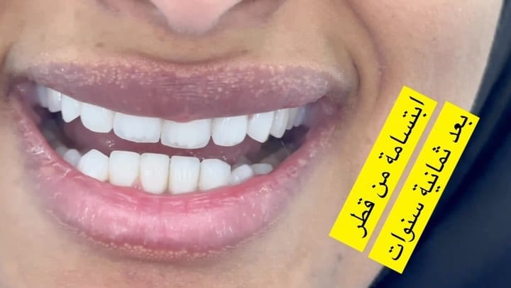 Post 5 by Racha Ghazal on Instagram (video)