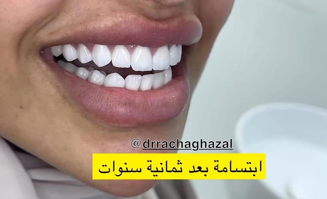Post 4 by Racha Ghazal on Instagram (video)