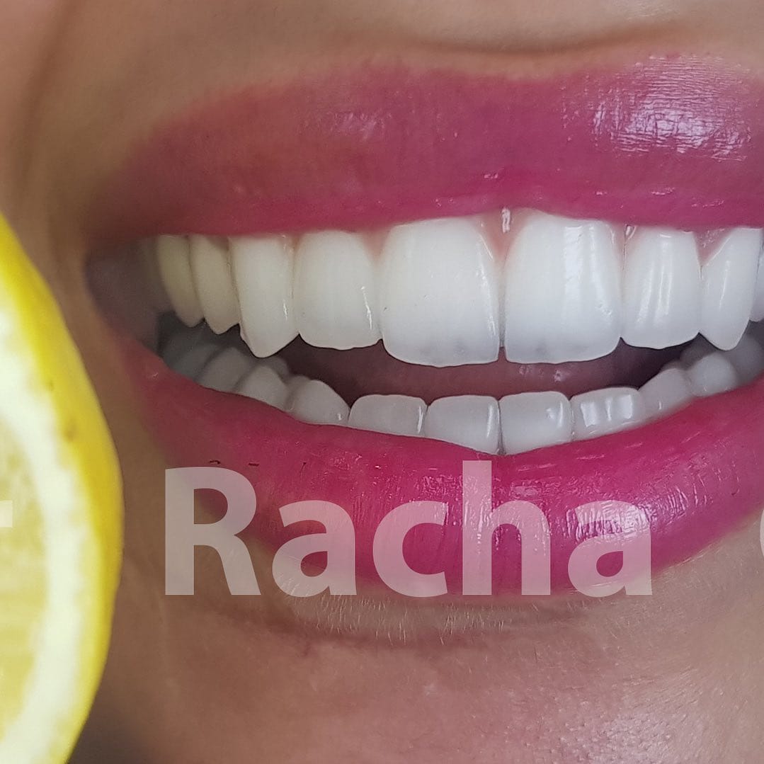 Post 8 by Racha Ghazal on Instagram (image)