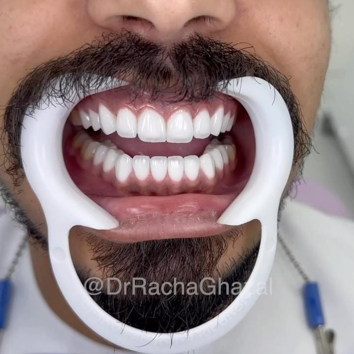 Post 10 by Racha Ghazal on Instagram (video)