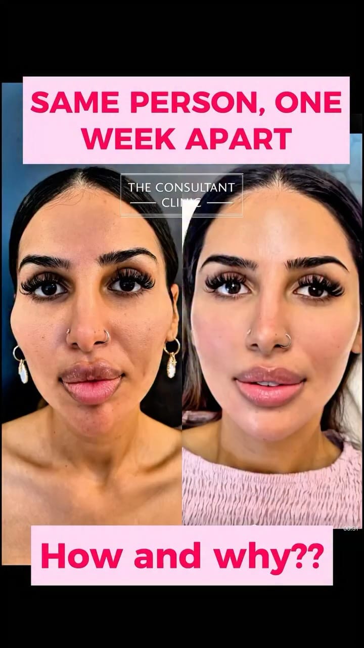Post 10 by The Consultant Clinic on Instagram (video)