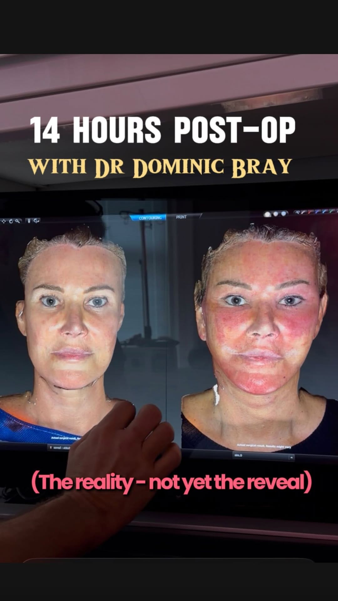 Post 4 by The Consultant Clinic on Instagram (video)