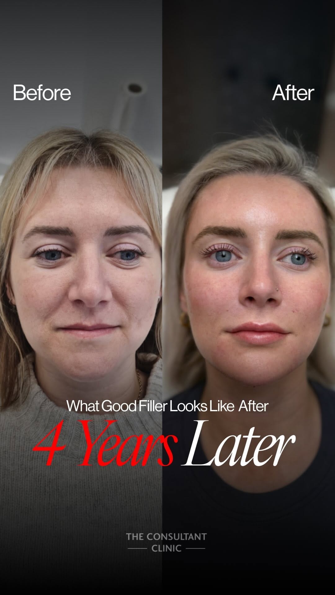Post 5 by The Consultant Clinic on Instagram (video)