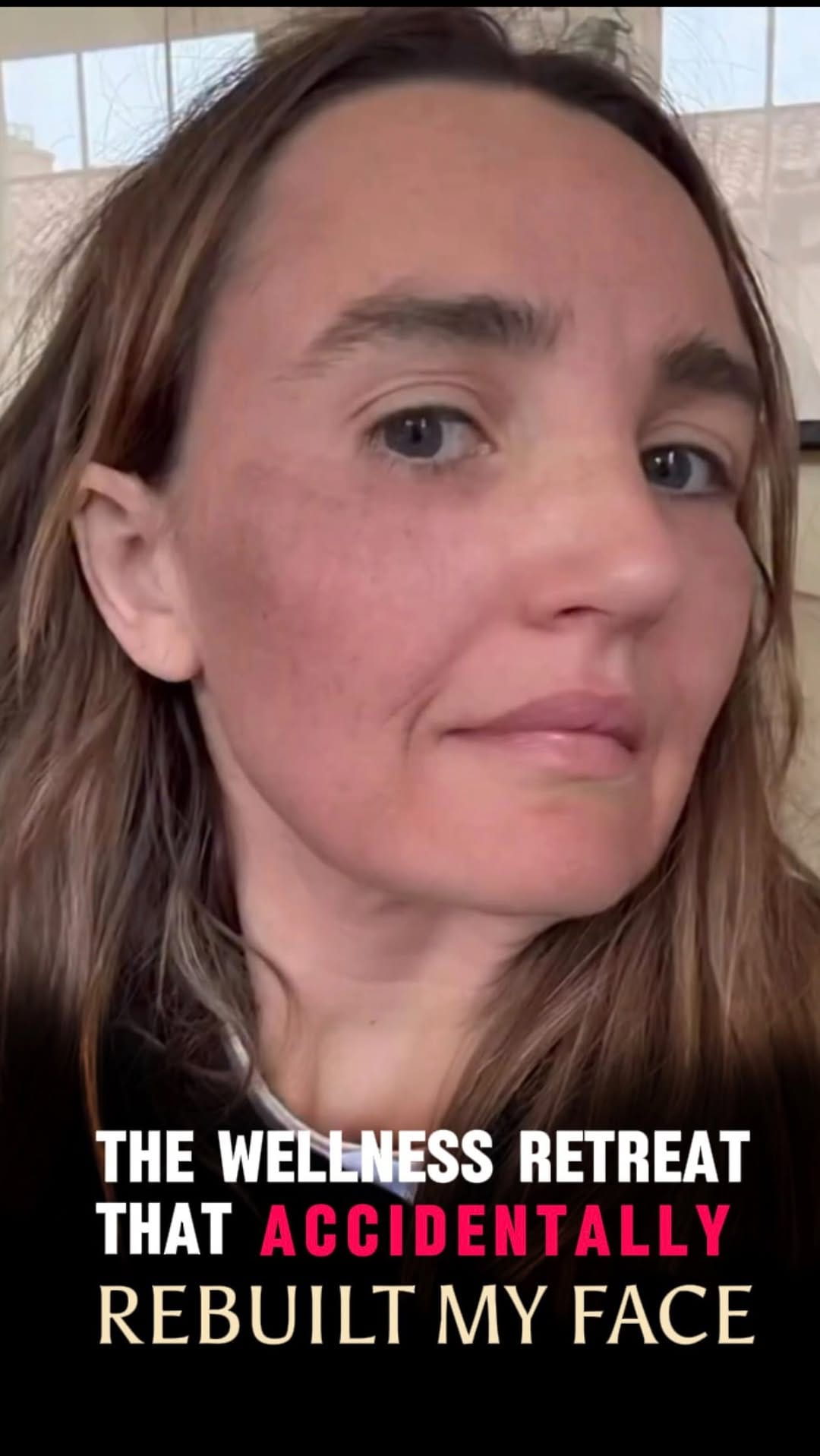 Post 8 by The Consultant Clinic on Instagram (video)
