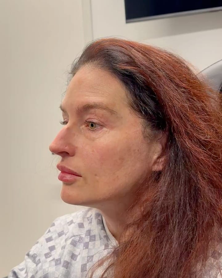 Post 4 by Adam Bryce Weinfeld, MD on Instagram (carousel)