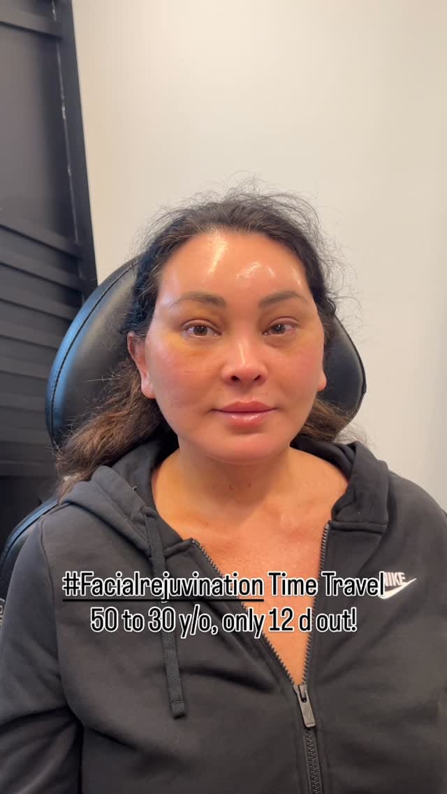 Post 5 by Adam Bryce Weinfeld, MD on Instagram (video)