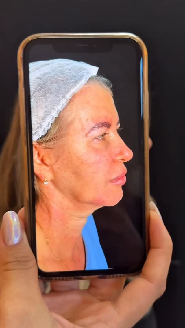 Post 7 by Dra. Alice Sampaio on Instagram (video)