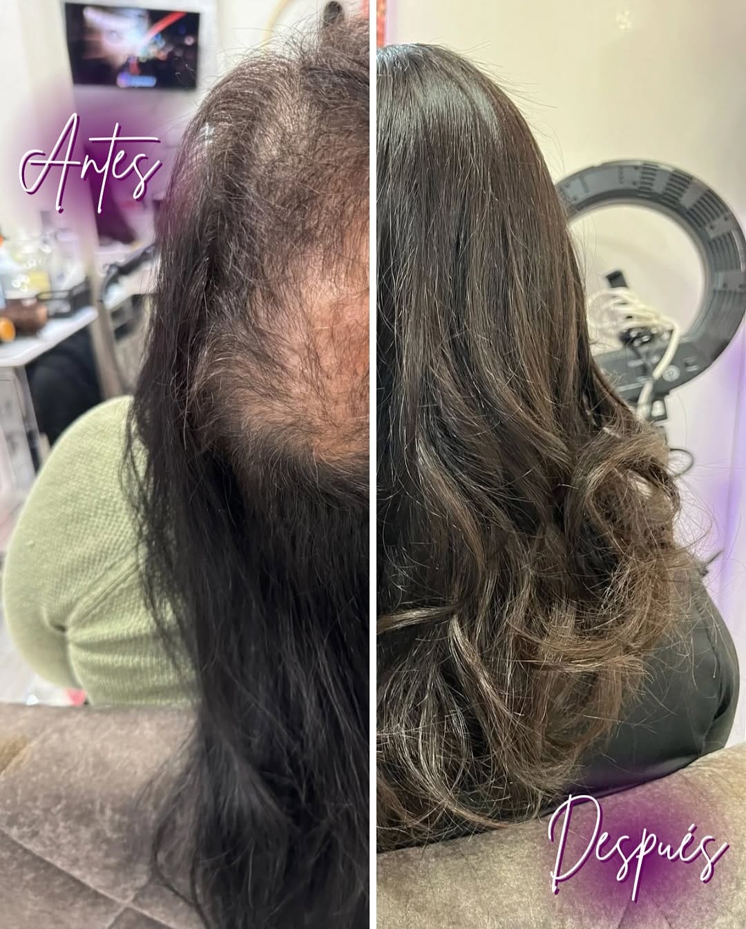 Post 9 by Krailes Hair Extensions Clinic on Instagram (carousel)