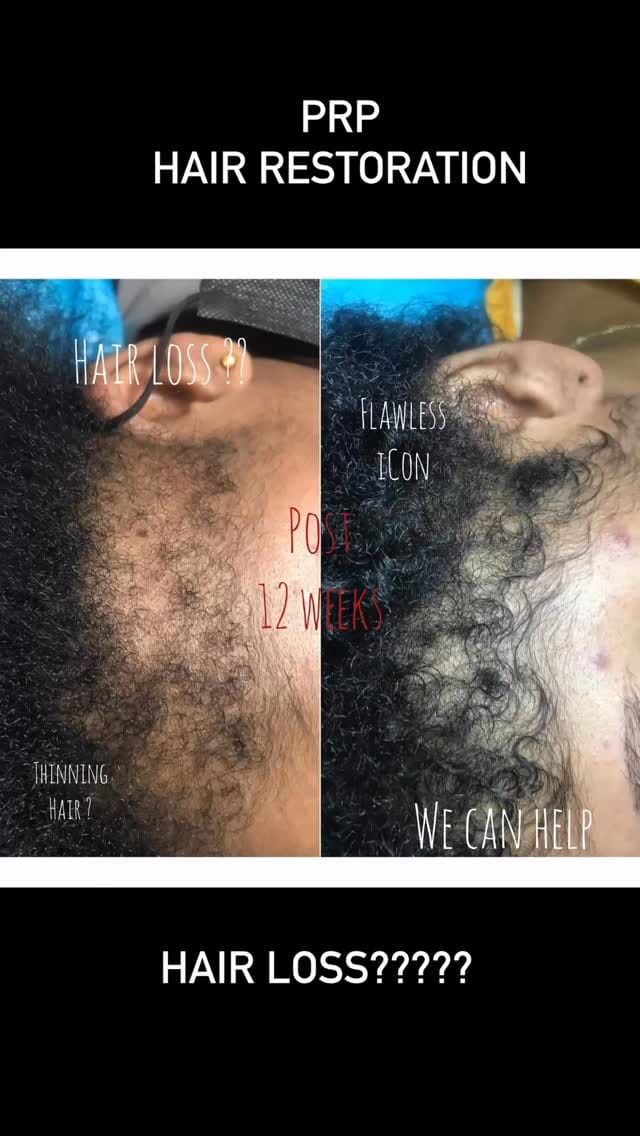 Post 9 by FLAWLESS ICON | Health & Wellness Specialist | Miami on Instagram (video)