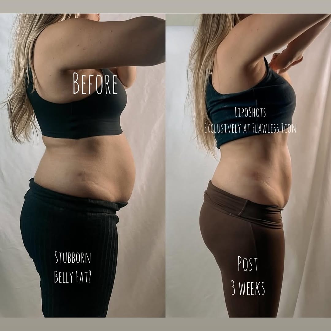 Post 2 by FLAWLESS ICON | Health & Wellness Specialist | Miami on Instagram (image)