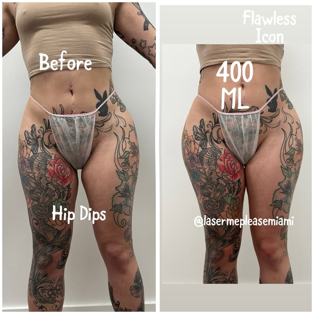 Post 8 by FLAWLESS ICON | Health & Wellness Specialist | Miami on Instagram (image)