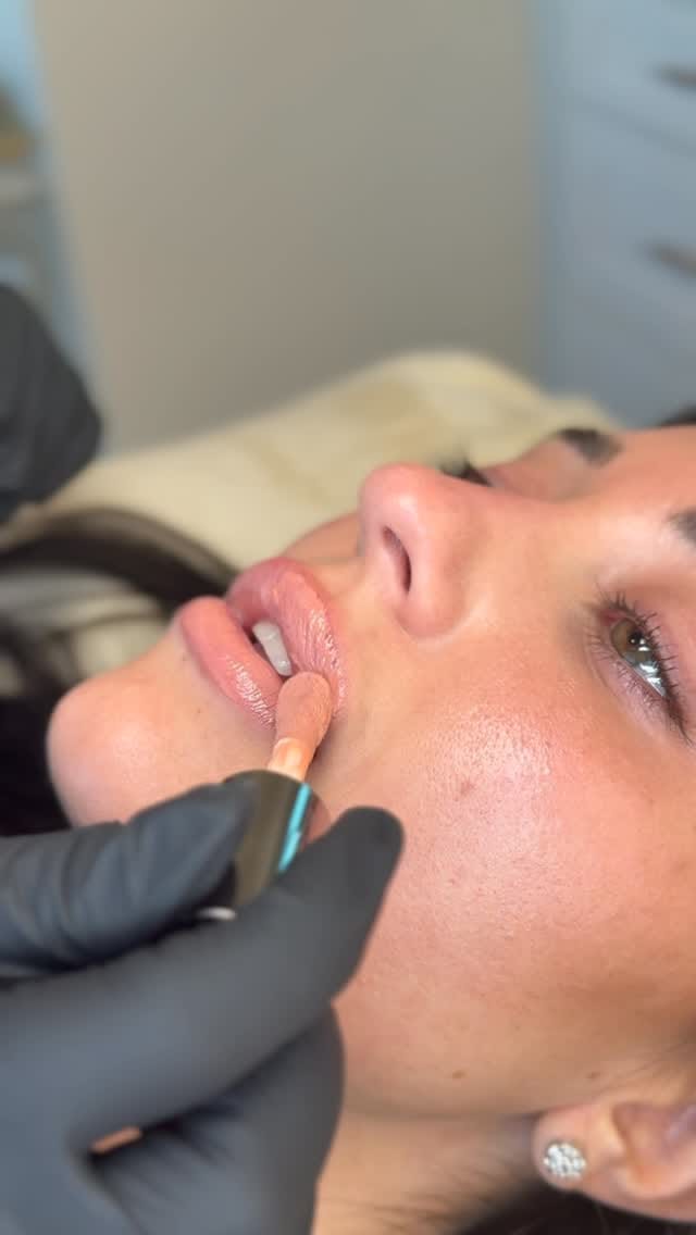 Post 1 by LaserGlow™ Teeth Whitening on Instagram (video)