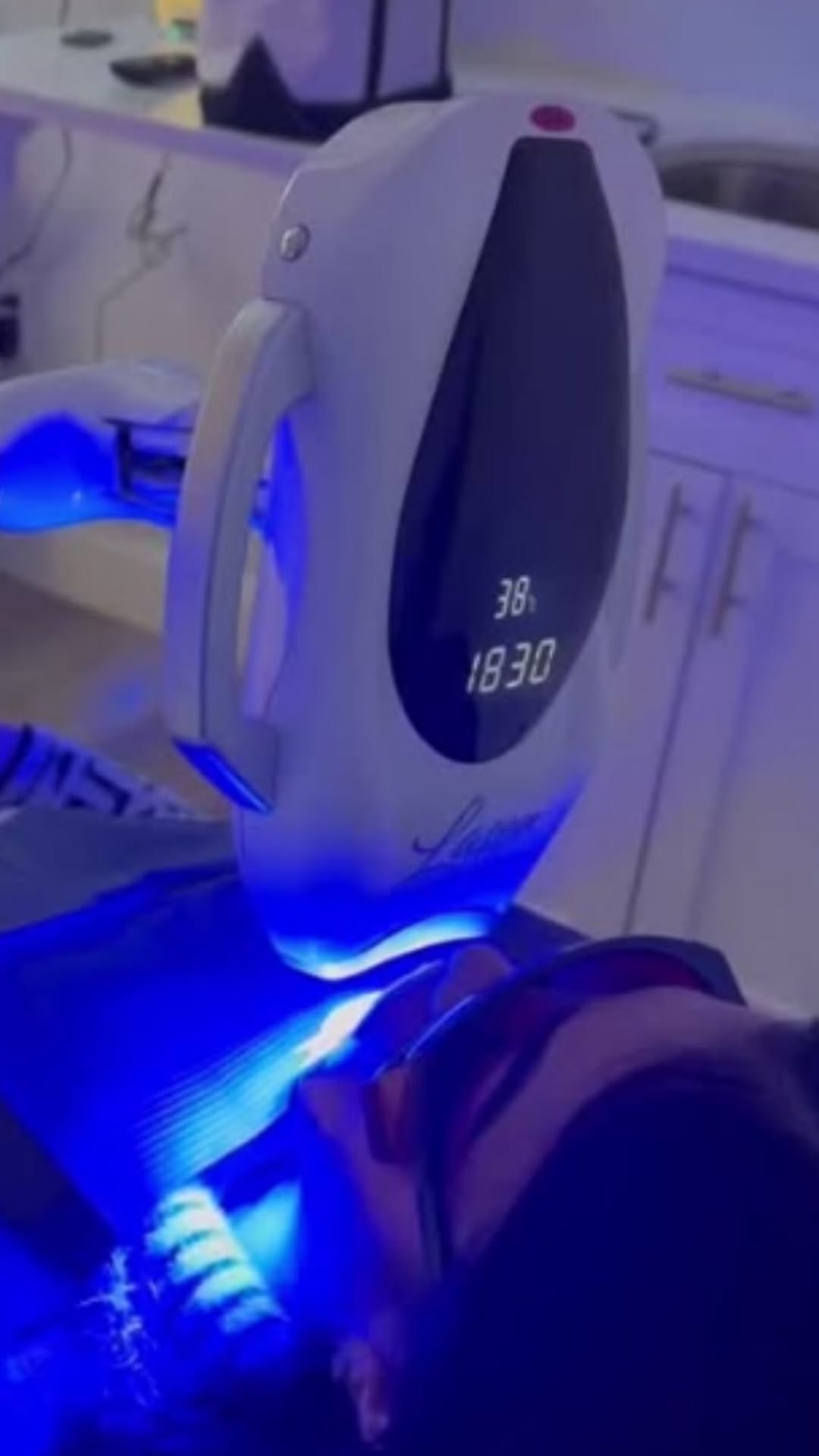 Post 3 by LaserGlow™ Teeth Whitening on Instagram (video)