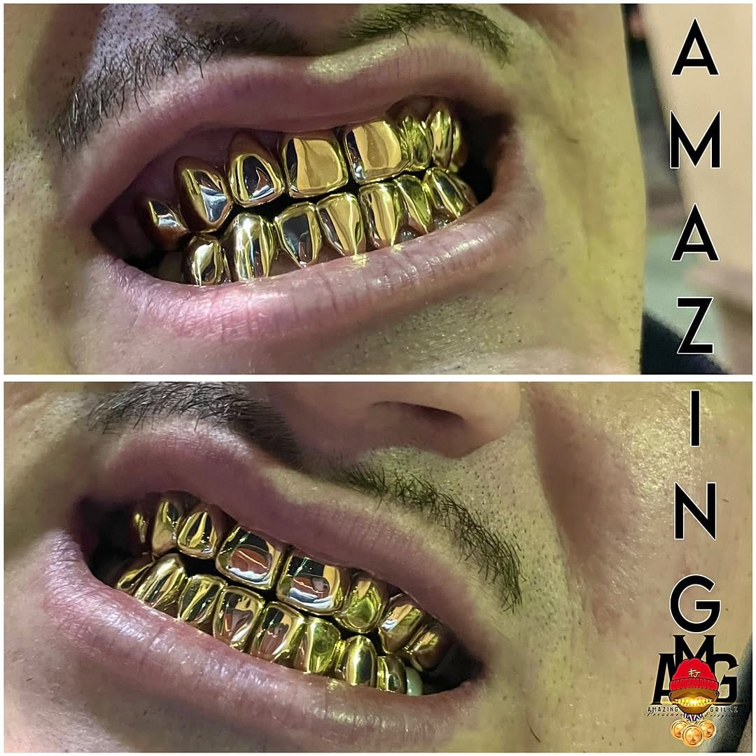 Post 6 by AMAZING GRILLZ on Instagram (image)