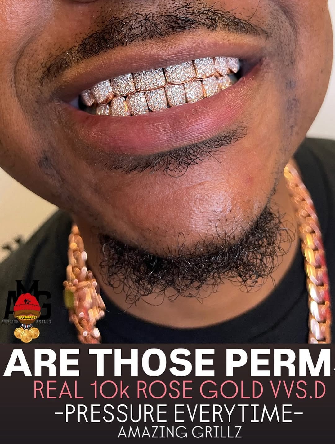 Post 2 by AMAZING GRILLZ on Instagram (carousel)