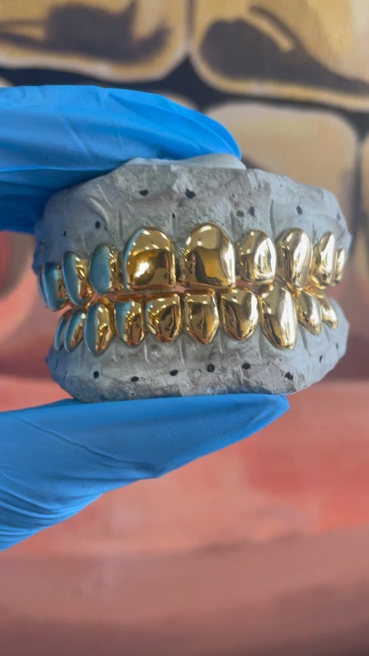 Post 10 by R&J GOLD GRILLZ on Instagram (video)