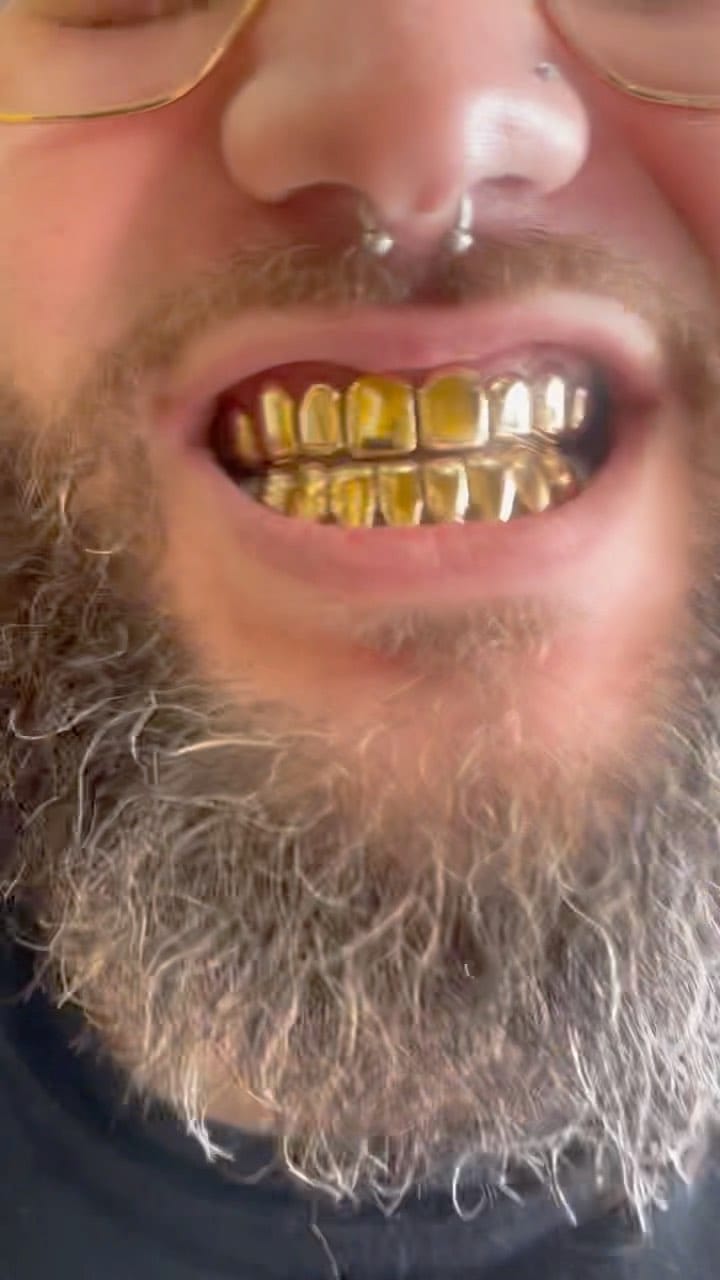 Post 9 by R&J GOLD GRILLZ on Instagram (video)