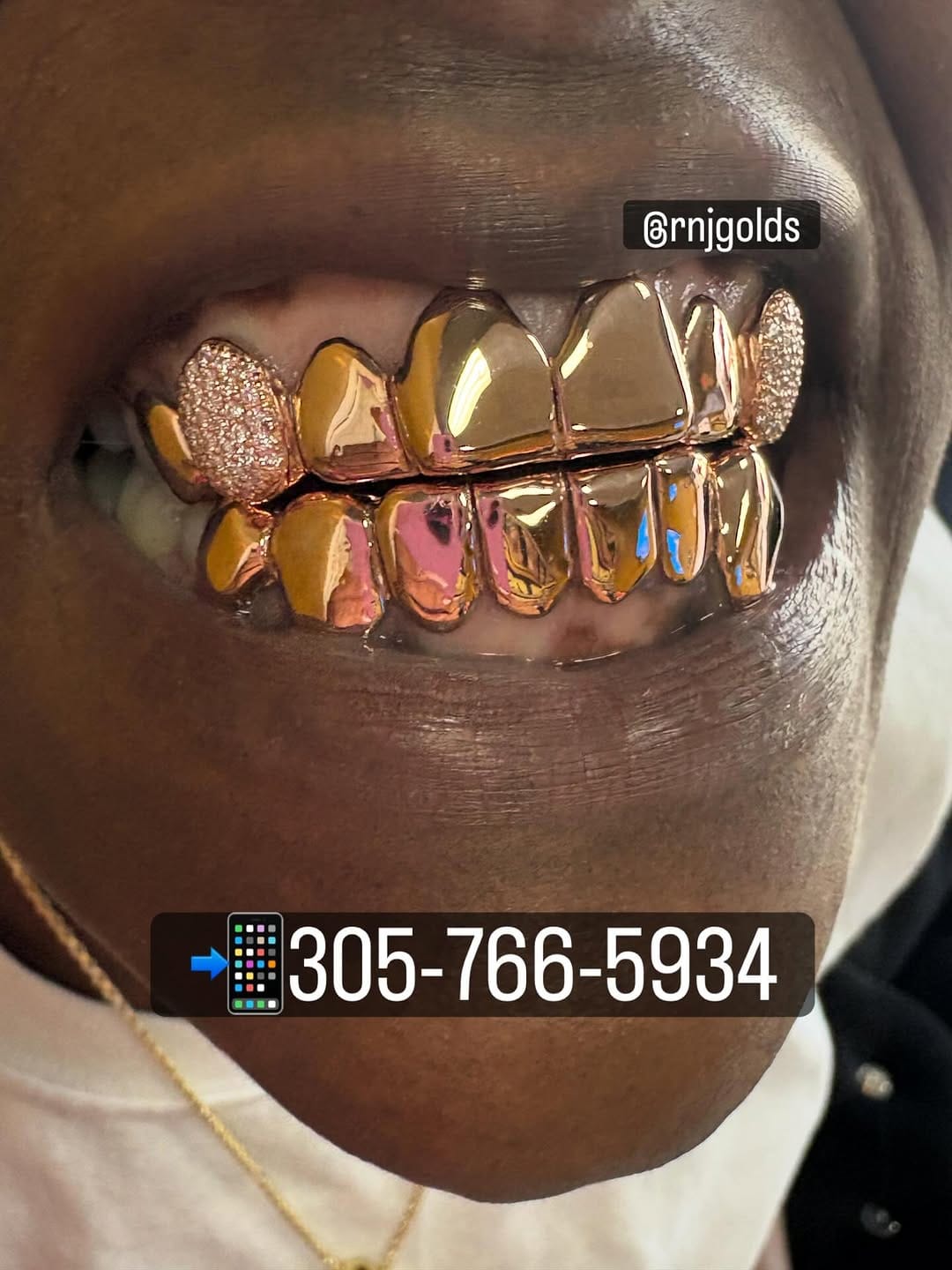 Post 2 by R&J GOLD GRILLZ on Instagram (carousel)