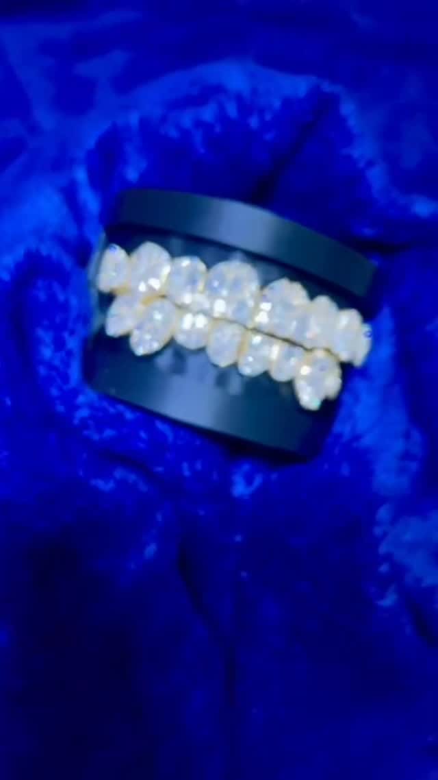 Post 2 by Seattle Gold Grills on Instagram (video)