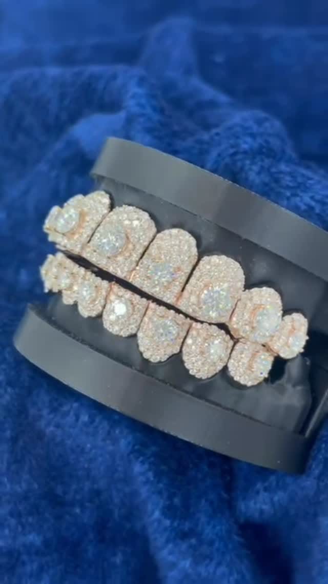Post 3 by Seattle Gold Grills on Instagram (video)
