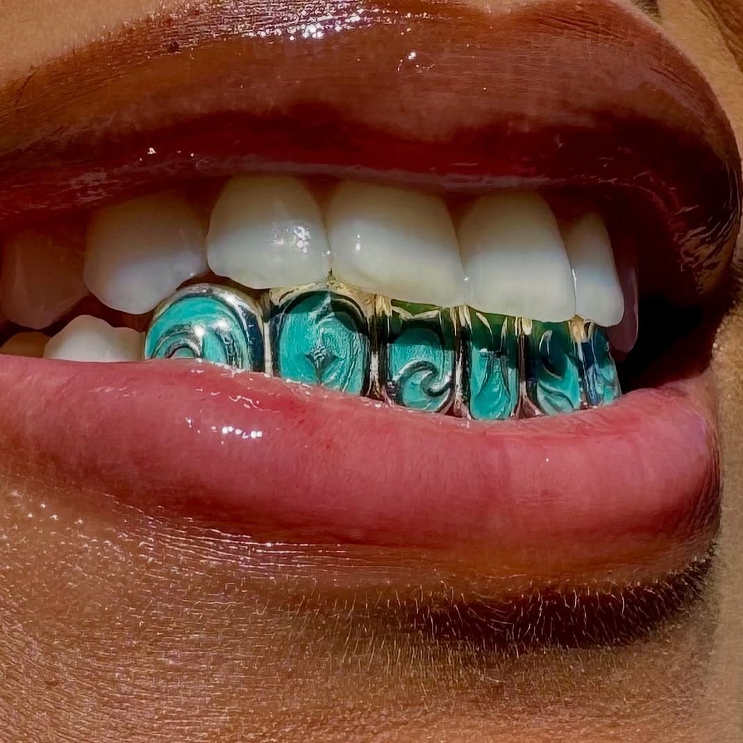 Post 5 by Zero Below Grillz on Instagram (carousel)