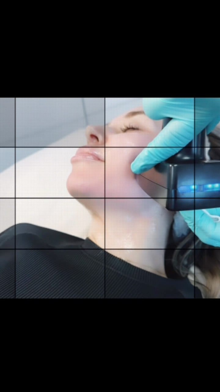 Post 3 by Ooh La La Med Spa on Instagram (video)