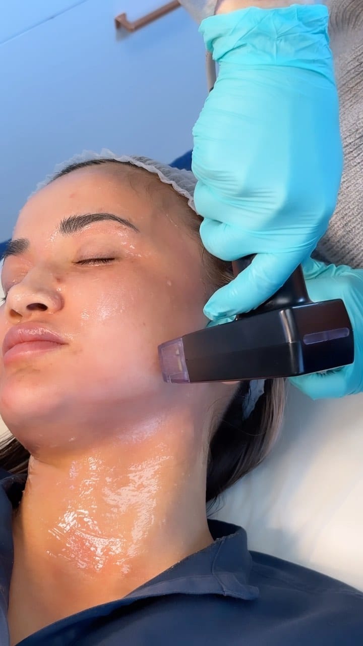 Post 4 by Ooh La La Med Spa on Instagram (video)
