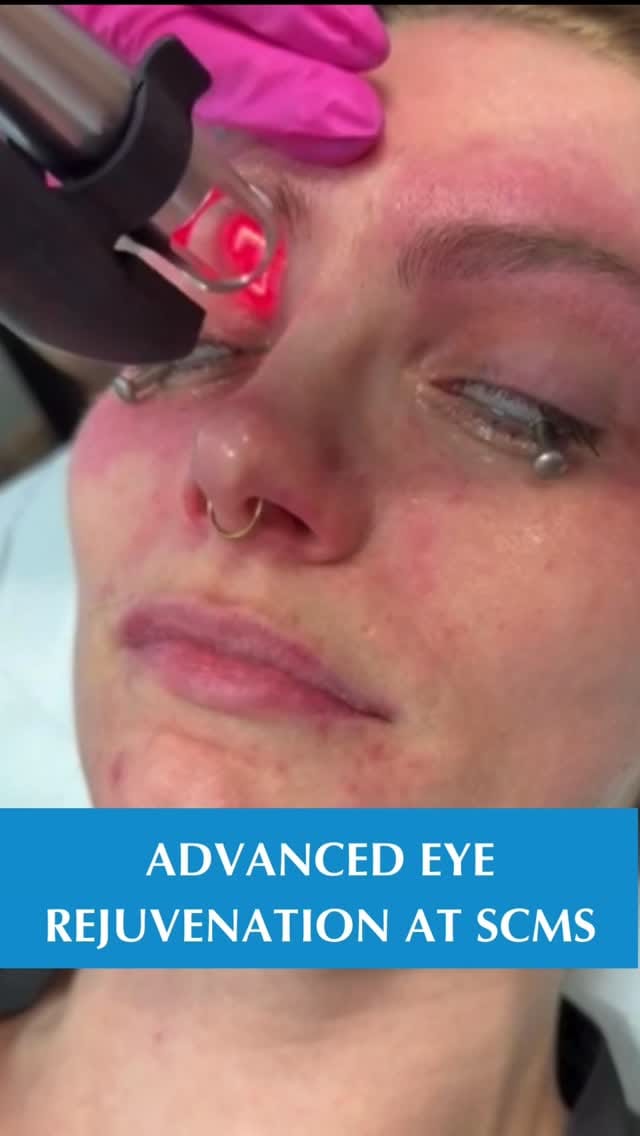 Post 8 by South Coast MedSpa on Instagram (video)