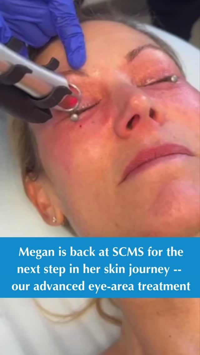 Post 6 by South Coast MedSpa on Instagram (video)