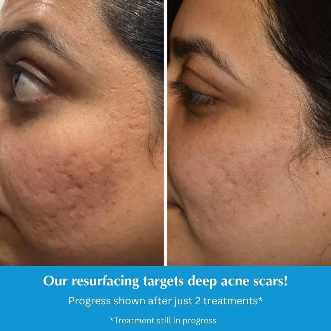 Post 7 by South Coast MedSpa on Instagram (carousel)