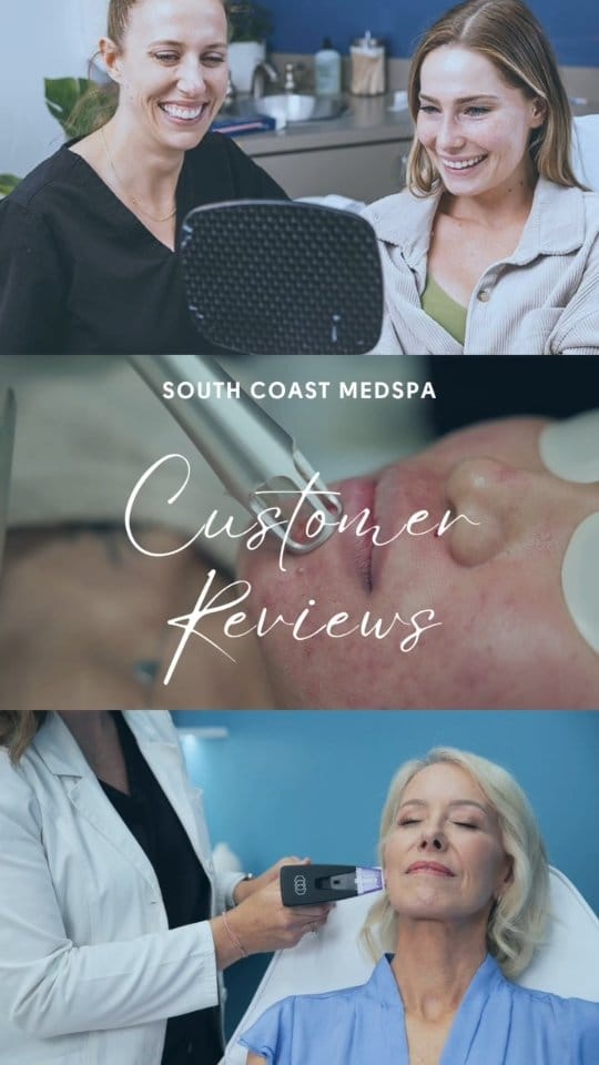 Post 2 by South Coast MedSpa on Instagram (video)