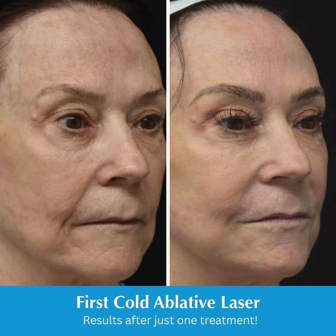 Post 4 by South Coast MedSpa on Instagram (carousel)